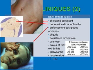 SIGNES CLINIQUES (2)SIGNES CLINIQUES (2)
DSH intracellulaire DSH extracellulaire
• pli cutané persistant
• dépression de la fontanelle
• enfoncement des globes
oculaires
• oligurie
• défaillance circulatoire:
- cyanose
- pâleur et refroidissement des
extrémités
- tachycardie
- hypotension
- ↑ TRC
 