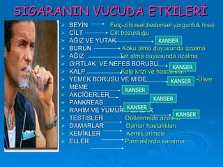 SİGARANIN VUCUDA ETKİLERİ
         BEYİN       Felç-zihinsel,bedensel yorgunluk hissi
         CİLT        Cilt bozukluğu
         AĞIZ VE YUTAK                   KANSER
         BURUN            Koku alma duyusunda azalma
         AĞIZ            Tat alma duyusunda azalma
         GIRTLAK VE NEFES BORUSU
                                               KANSER
         KALP             Kalp krizi ve hastalıkları
         YEMEK BORUSU VE MİDE                KANSER -Ülser
         MEME              KANSER
         AKCİĞERLER
                                        KANSER
         PANKREAS
                             KANSER
         RAHİM VE YUMURTALIKLAR
                                                KANSER
         TESTİSLER         Döllenmede azalma
         DAMARLAR           Damar hastalıkları
         KEMİKLER           Kemik erimesi
         ELLER             Parmaklarda sararma
 