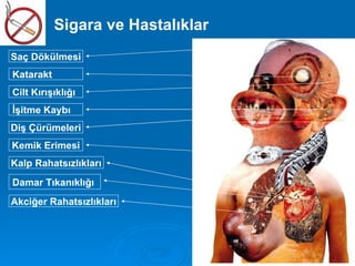 Sigara ve Hastalıklar
Saç Dökülmesi
Katarakt
Cilt Kırışıklığı
İşitme Kaybı
Diş Çürümeleri
Kemik Erimesi
Kalp Rahatsızlıkları
Damar Tıkanıklığı
Akciğer Rahatsızlıkları
 