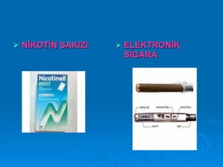   NİKOTİN SAKIZI      ELEKTRONİK
                         SİGARA
 