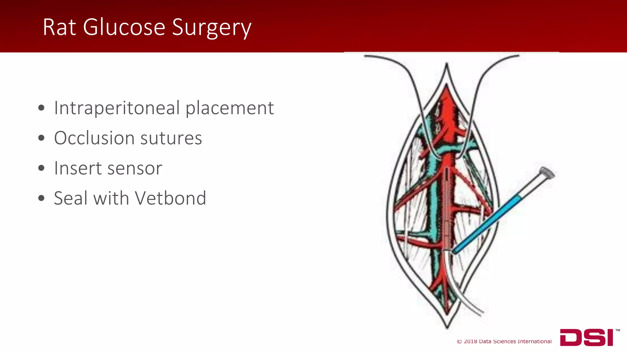 © 2018 Data Sciences International
Rat Glucose Surgery
• Intraperitoneal placement
• Occlusion sutures
• Insert sensor
• Seal with Vetbond
Rat Glucose Surgery
 