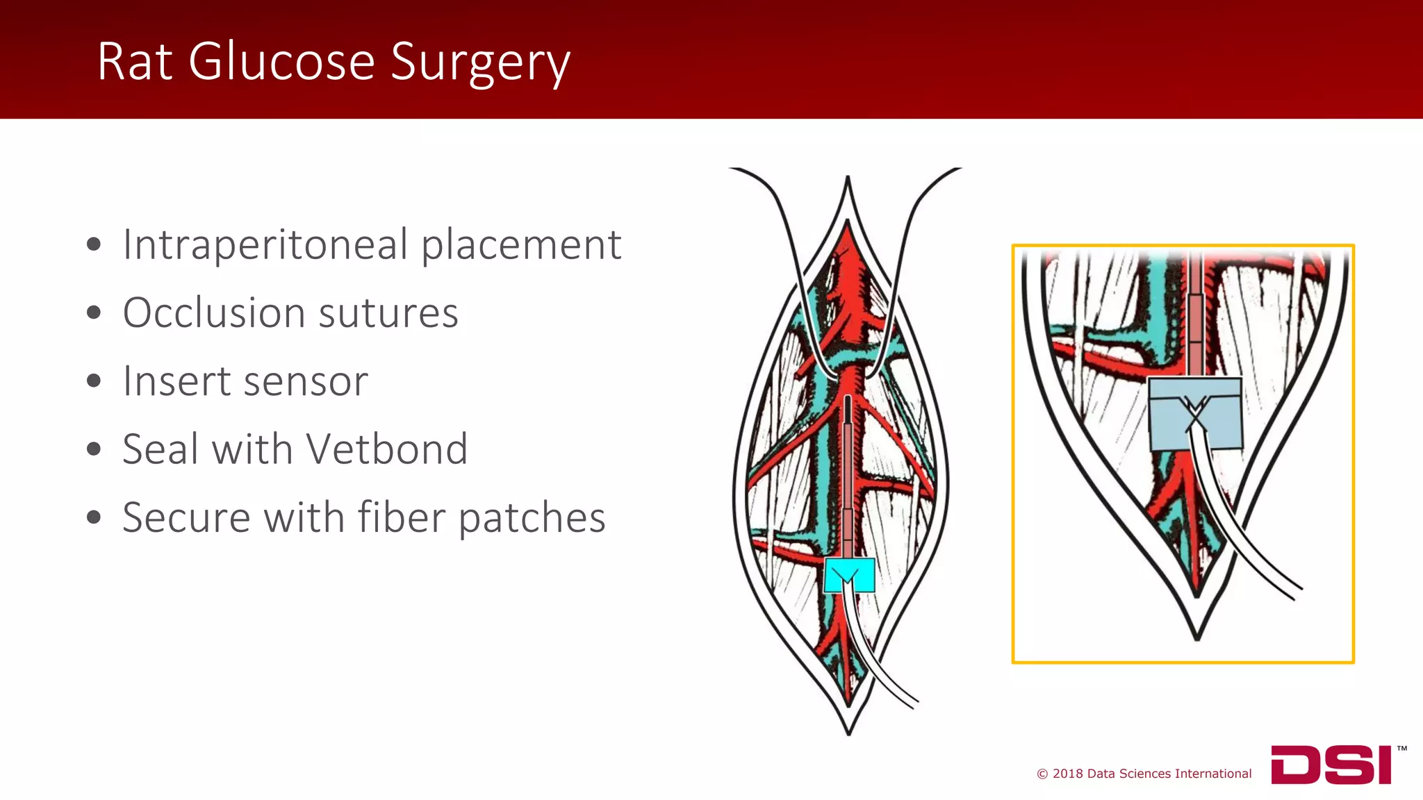 © 2018 Data Sciences International
Rat Glucose Surgery
• Intraperitoneal placement
• Occlusion sutures
• Insert sensor
• Seal with Vetbond
• Secure with fiber patches
Rat Glucose Surgery
 