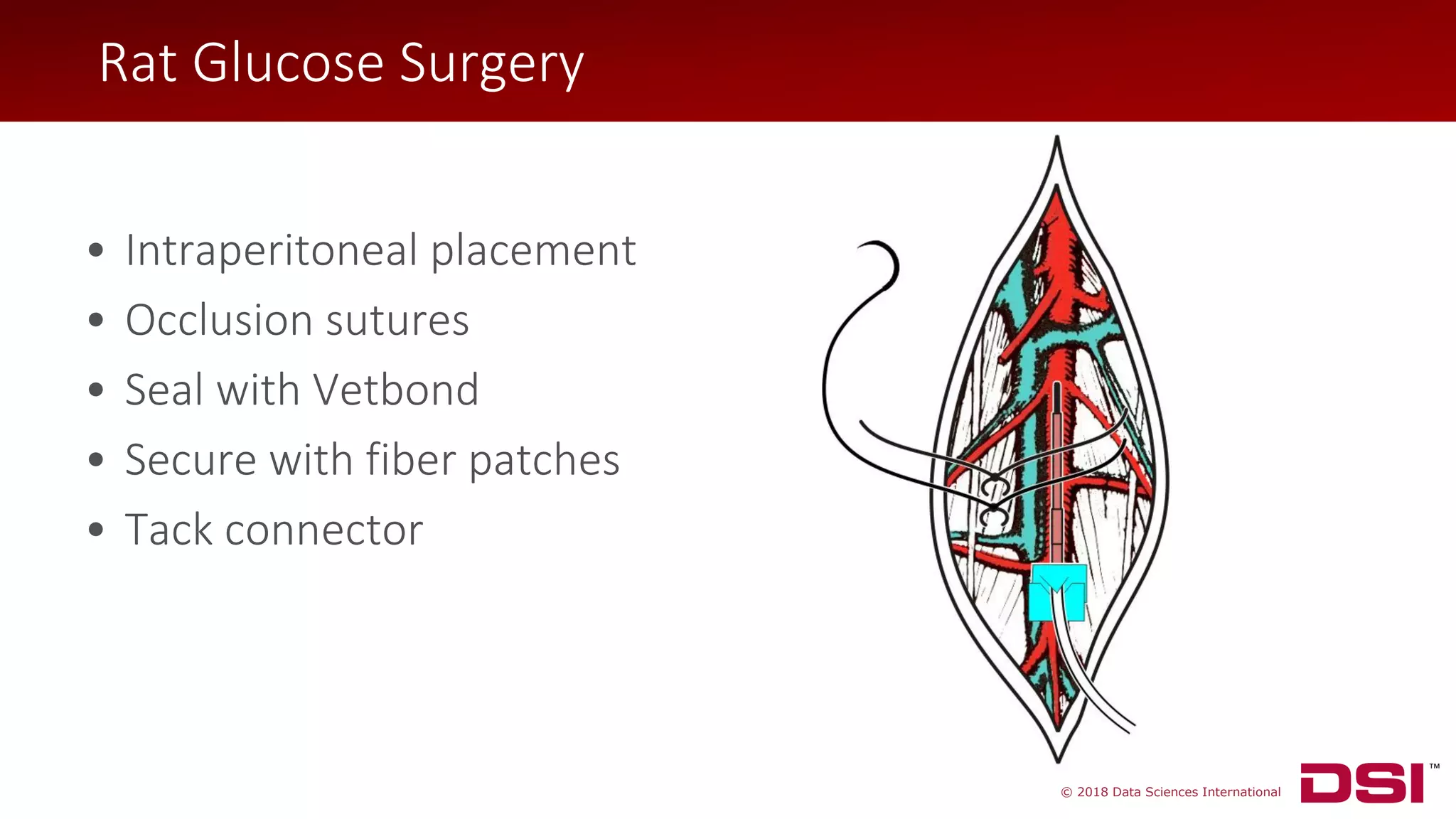 © 2018 Data Sciences International
Rat Glucose Surgery
• Intraperitoneal placement
• Occlusion sutures
• Seal with Vetbond
• Secure with fiber patches
• Tack connector
Rat Glucose Surgery
 