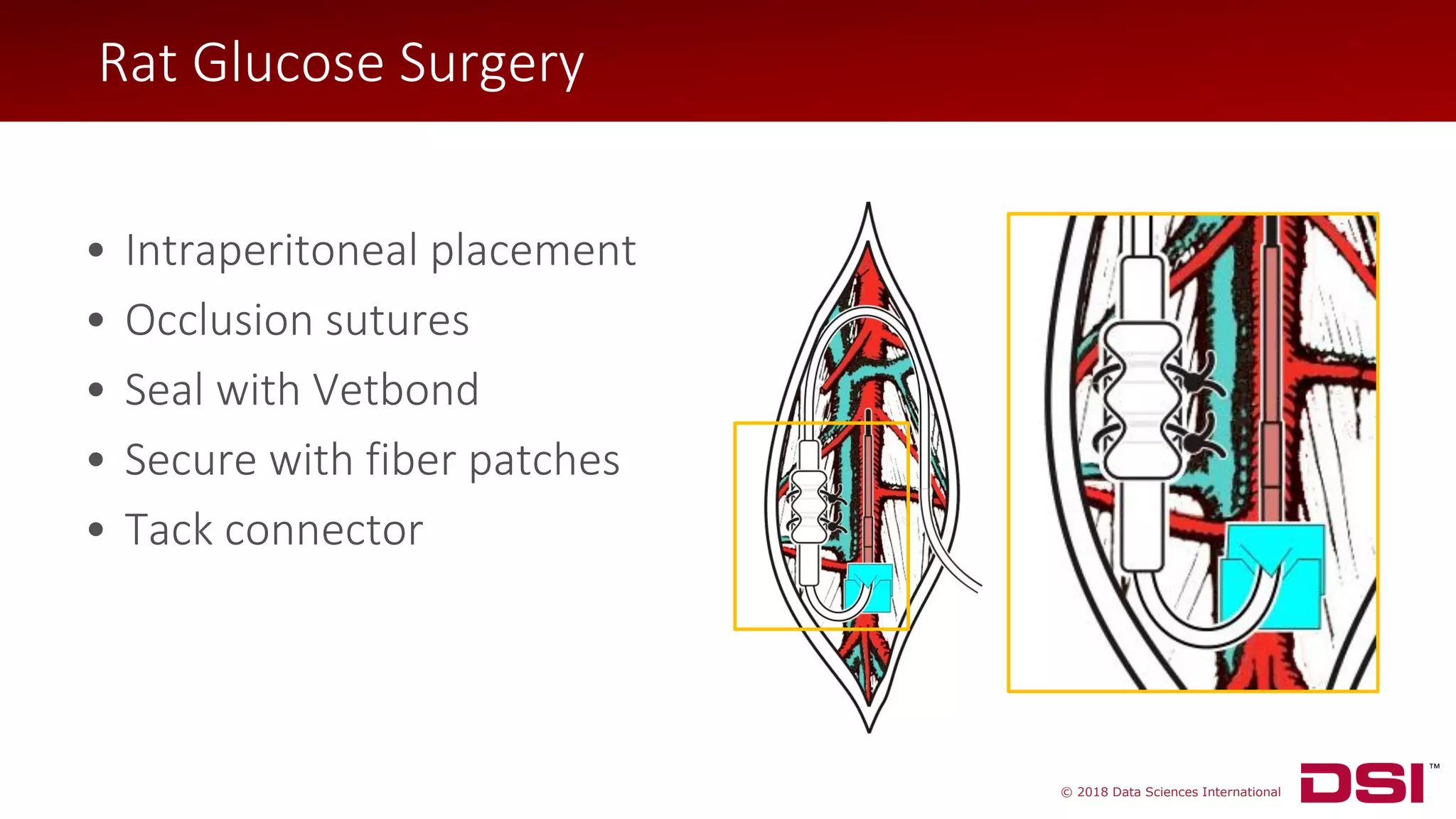 © 2018 Data Sciences International
Rat Glucose Surgery
• Intraperitoneal placement
• Occlusion sutures
• Seal with Vetbond
• Secure with fiber patches
• Tack connector
Rat Glucose Surgery
 