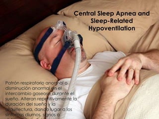 Central Sleep Apnea and
Sleep-Related
Hypoventilation
Patrón respiratorio anormal o
disminución anormal en el
intercambio gaseoso durante el
sueño. Alteran repetitivamente la
duración del sueño y la
arquitectura, dando lugar a los
síntomas diurnos, signos o
 