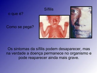 Sífilis
 o que é?


Como se pega?




 Os sintomas da sífilis podem desaparecer, mas
na verdade a doença permanece no organismo e
       pode reaparecer ainda mais grave.
 