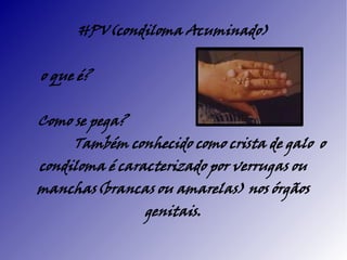 HPV(condiloma Acuminado)


o que é?


Como se pega?
     Também conhecido como crista de galo o
condiloma é caracterizado por verrugas ou
manchas(brancas ou amarelas) nos órgãos
                genitais.
 