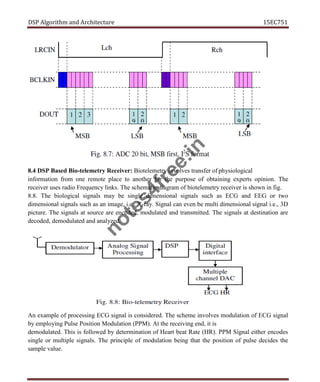 DSP Algorithm and Architecture 15EC751
8.4 DSP Based Bio-telemetry Receiver: Biotelemetry involves transfer of physiological
information from one remote place to another for the purpose of obtaining experts opinion. The
receiver uses radio Frequency links. The schematic diagram of biotelemetry receiver is shown in fig.
8.8. The biological signals may be single dimensional signals such as ECG and EEG or two
dimensional signals such as an image, i.e., X-ray. Signal can even be multi dimensional signal i.e., 3D
picture. The signals at source are encoded, modulated and transmitted. The signals at destination are
decoded, demodulated and analyzed.
An example of processing ECG signal is considered. The scheme involves modulation of ECG signal
by employing Pulse Position Modulation (PPM). At the receiving end, it is
demodulated. This is followed by determination of Heart beat Rate (HR). PPM Signal either encodes
single or multiple signals. The principle of modulation being that the position of pulse decides the
sample value.
n
o
t
e
s
4
f
r
e
e
.
i
n
 