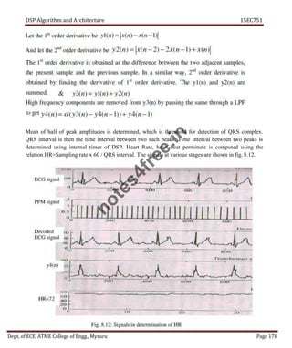 DSP Algorithm and Architecture 15EC751
Dept. of ECE, ATME College of Engg., Mysuru Page 178
Mean of half of peak amplitudes is determined, which is threshold for detection of QRS complex.
QRS interval is then the time interval between two such peaks. Time Interval between two peaks is
determined using internal timer of DSP. Heart Rate, heart beat perminute is computed using the
relation HR=Sampling rate x 60 / QRS interval. The signals at various stages are shown in fig. 8.12.
n
o
t
e
s
4
f
r
e
e
.
i
n
 