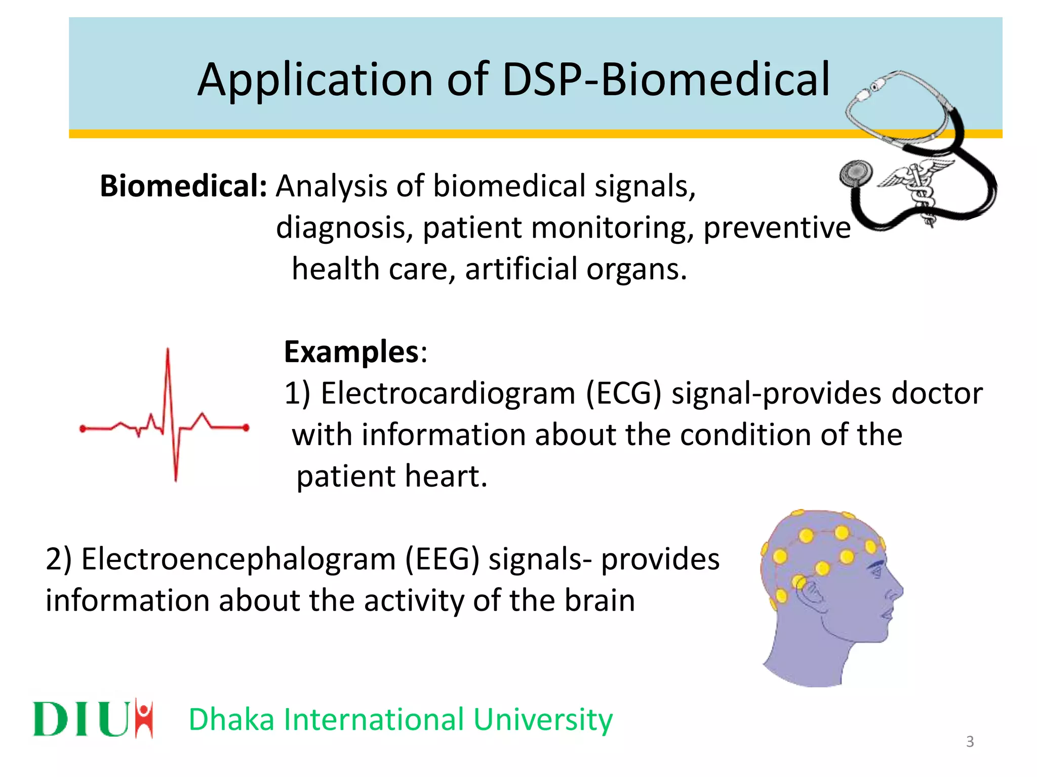 Dhaka International University Application of DSP-Biomedical Biomedical: Analysis of biomedical signals, diagnosis, patient monitoring, preventive health care, artificial organs. Examples: 1) Electrocardiogram (ECG) signal-provides doctor with information about the condition of the patient heart. 2) Electroencephalogram (EEG) signals- provides information about the activity of the brain 3 