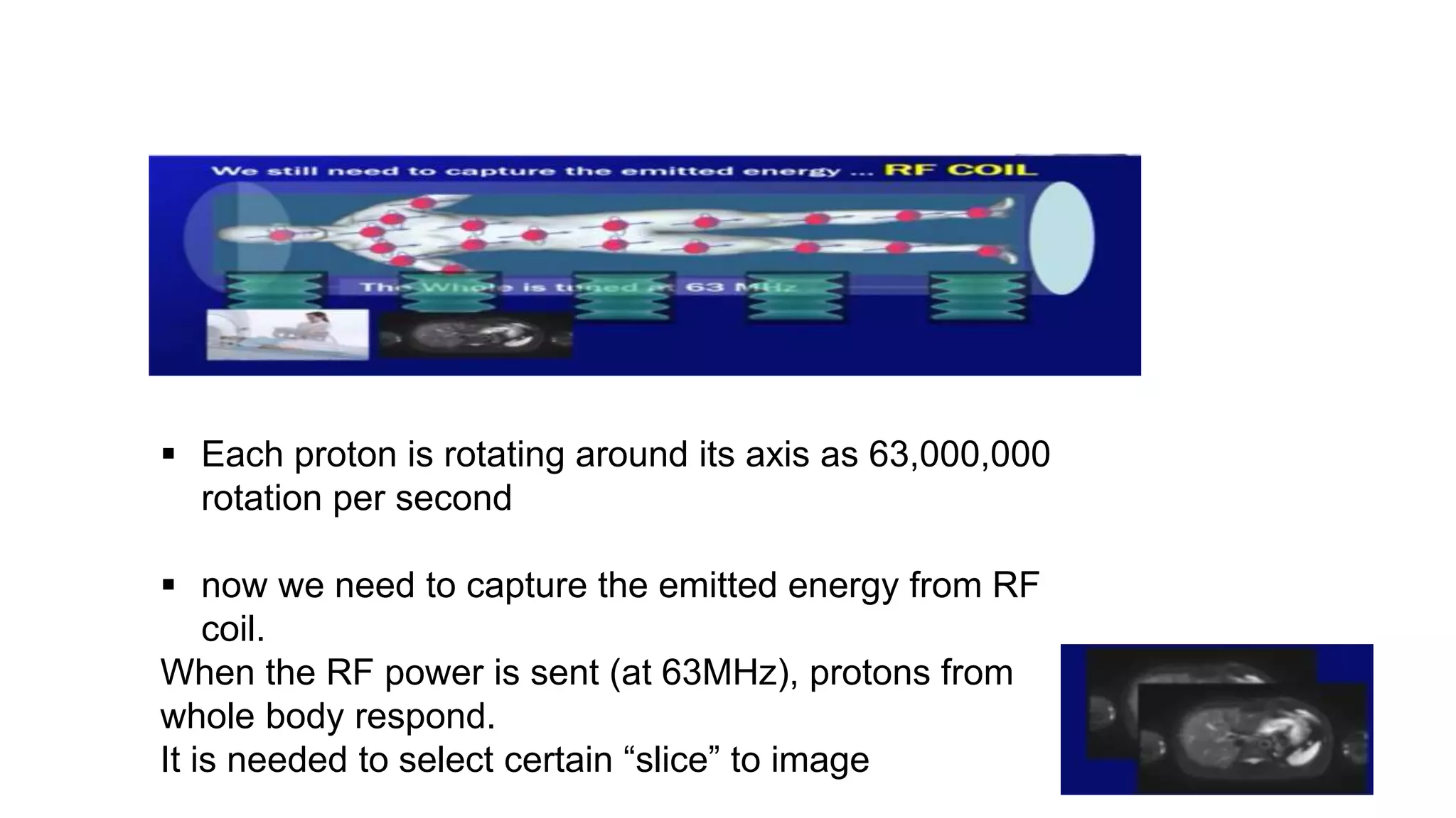  Each proton is rotating around its axis as 63,000,000
rotation per second
 now we need to capture the emitted energy from RF
coil.
When the RF power is sent (at 63MHz), protons from
whole body respond.
It is needed to select certain “slice” to image
 