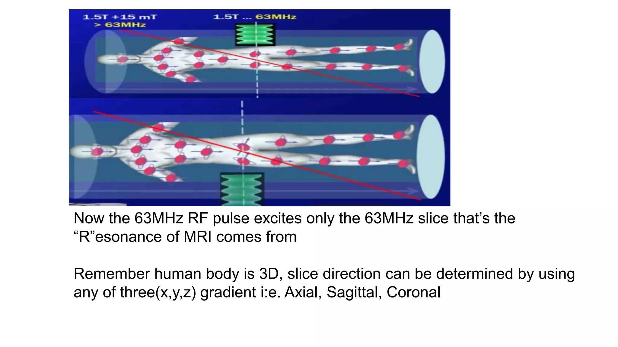 Now the 63MHz RF pulse excites only the 63MHz slice that’s the
“R”esonance of MRI comes from
Remember human body is 3D, slice direction can be determined by using
any of three(x,y,z) gradient i:e. Axial, Sagittal, Coronal
 