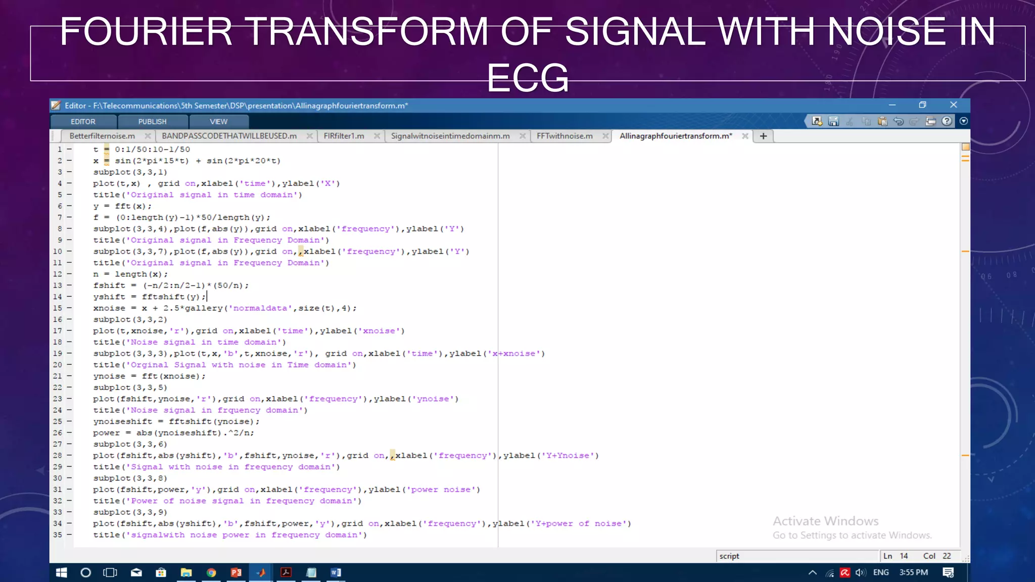 FOURIER TRANSFORM OF SIGNAL WITH NOISE IN
ECG
 