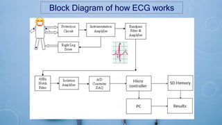 Block Diagram of how ECG works
 