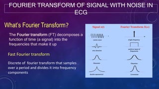 FOURIER TRANSFORM OF SIGNAL WITH NOISE IN
ECG
What’s Fourier Transform?
The Fourier transform (FT) decomposes a
function of time (a signal) into the
frequencies that make it up
Fast Fourier transform
Discrete of fourier transform that samples
over a period and divides it into frequency
components
 