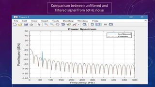 Comparison between unfiltered and
filtered signal from 60 Hz noise
 
