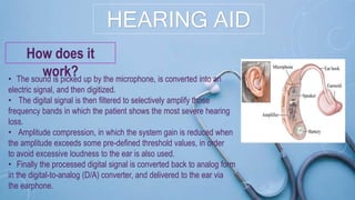 HEARING AID
How does it
work?• The sound is picked up by the microphone, is converted into an
electric signal, and then digitized.
• The digital signal is then filtered to selectively amplify those
frequency bands in which the patient shows the most severe hearing
loss.
• Amplitude compression, in which the system gain is reduced when
the amplitude exceeds some pre-defined threshold values, in order
to avoid excessive loudness to the ear is also used.
• Finally the processed digital signal is converted back to analog form
in the digital-to-analog (D/A) converter, and delivered to the ear via
the earphone.
 