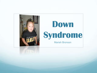 Down
Syndrome
  Mariah Bronson
 