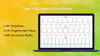 11
👉ARR: Arrhythmias
👉CHF: Congestive Heart Failure
👉NSR: Normal Sinus Rhythm
Types of ECG Signals for Classification
 