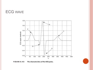 ECG WAVE
 