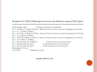 courtesy: DSP by Li Tan
 