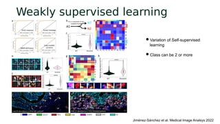 Deep Learning Glioma Grading with the Tumor Microenvironment Analysis ...