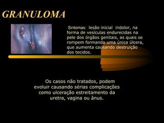 GRANULOMA   Os casos não tratados, podem evoluir causando sérias complicações como ulceração estreitamento da uretra, vagina ou ânus. Sintomas:  lesão inicial  indolor, na forma de vesículas endurecidas na pele dos órgãos genitais, as quais se rompem formando uma única úlcera, que aumenta causando destruição dos tecidos. 