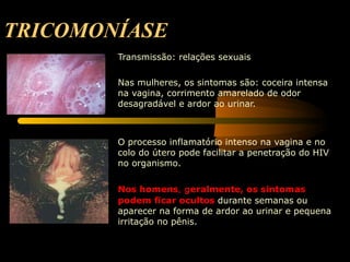 TRICOMONÍASE Transmissão: relações sexuais  Nas mulheres, os sintomas são: coceira intensa na vagina, corrimento amarelado de odor desagradável e ardor ao urinar.    O processo inflamatório intenso na vagina e no colo do útero pode facilitar a penetração do HIV no organismo.  Nos homens , g eralmente, os sintomas podem ficar ocultos  durante semanas ou aparecer na forma de ardor ao urinar e pequena irritação no pênis. 