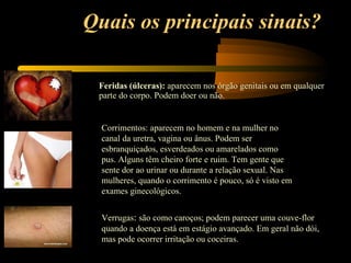 Quais os principais sinais? Feridas (úlceras):  aparecem nos órgão genitais ou em qualquer parte do corpo. Podem doer ou não. Corrimentos: aparecem no homem e na mulher no canal da uretra, vagina ou ânus. Podem ser esbranquiçados, esverdeados ou amarelados como pus. Alguns têm cheiro forte e ruim. Tem gente que sente dor ao urinar ou durante a relação sexual. Nas mulheres, quando o corrimento é pouco, só é visto em exames ginecológicos. Verrugas :  são como caroços; podem parecer uma couve-flor quando a doença está em estágio avançado. Em geral não dói, mas pode ocorrer irritação ou coceiras. 