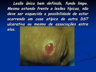 Lesão única bem definida, fundo limpo. Mesmo estando frente a lesões típicas, não deve ser esquecida a possibilidade de estar ocorrendo um caso atípico de outra DST ulcerativa ou mesmo de associações entre elas. 