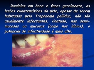 Roséolas em boca e face: geralmente, as lesões exantemáticas da pele, apesar de serem habitadas pelo Treponema pallidun, não são usualmente infectantes. Contudo, nas semi-mucosas ou mucosas (como nos lábios), o potencial de infectividade é mais alto. 