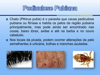 Pediculose Pubiana
   Chato (Pthirus pubis) é o parasita que causa pediculose
    pubiana ou ftiríase e habita os pelos da região pubiana
    principalmente, mas pode ainda ser encontrado nas
    coxas, baixo tórax, axilas e até na barba e no couro
    cabeludo.
   Nos locais da picada, podem ocorrer alterações da pele
    semelhantes à urticária, bolhas e manchas azuladas.
 