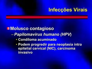 Infecções Virais Molusco contagioso Papilomavírus humano (HPV ) Condiloma acuminado Podem progredir para neoplasia intra epitelial cervical (NIC), carcinoma invasivo 
