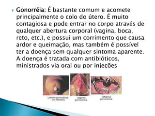  Gonorréia: É bastante comum e acomete
principalmente o colo do útero. É muito
contagiosa e pode entrar no corpo através de
qualquer abertura corporal (vagina, boca,
reto, etc.), e possui um corrimento que causa
ardor e queimação, mas também é possível
ter a doença sem qualquer sintoma aparente.
A doença é tratada com antibióticos,
ministrados via oral ou por injeções
 