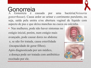 GonorreiaA Gonorreia é causada por uma bactéria(Neisseria
gonorrhoeae). Causa ardor ao urinar e corrimento purulento, ou
seja, saída pela uretra e/ou abertura vaginal de líquido com
aspecto de pus e que deixa manchas na cueca ou calcinha.
• Nas mulheres, pode não haver sintomas no
estágio inicial, porém, num estágio mais
avançado, pode causar dores no abdome
e, se não for tratada, causa esterilidade
(incapacidade de gerar filhos).
Após diagnosticada por um médico,
a doença pode ser tratada com antibiótico
receitado por ele. 5
 