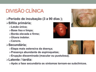 DIVISÃO CLÍNICA
Período de incubação (3 a 90 dias );
Sifílis primária;
Lesão única;
Base lisa e limpa;
Borda elevada e firme;
Úlcera indolor.
Cancro.
Secundária;
Etapa mais ostensiva da doença;
Presença abundante de espiroquetas;
Erupção disseminada (macular ou pustulosa).
Latente / tardia:
Após a fase secundária os sintomas tornam-se subclínicos.
 