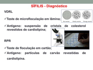 SÍFILIS - Diagnóstico
VDRL
Teste de microfloculação em lâmina;
Antígeno: suspensão de cristais de colesterol
revestidos de cardiolipina;
RPR
Teste de floculação em cartão;
Antígeno: partículas de carvão revestidas de
cardiolipina.
 