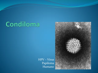 HPV – Vírus
Papiloma
Humano
 