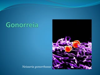 Neisseria gonorrhoeae
 
