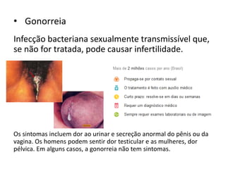 • Gonorreia
Infecção bacteriana sexualmente transmissível que,
se não for tratada, pode causar infertilidade.
Os sintomas incluem dor ao urinar e secreção anormal do pênis ou da
vagina. Os homens podem sentir dor testicular e as mulheres, dor
pélvica. Em alguns casos, a gonorreia não tem sintomas.
 
