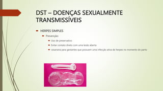 DST – DOENÇAS SEXUALMENTE
TRANSMISSÍVEIS
 HERPES SIMPLES
 Prevenção:
 Uso de preservativo
 Evitar contato direto com uma lesão aberta
 cesariana para gestantes que possuem uma infecção ativa de herpes no momento do parto
 