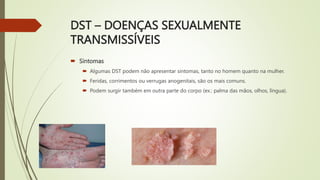 DST – DOENÇAS SEXUALMENTE
TRANSMISSÍVEIS
 Sintomas
 Algumas DST podem não apresentar sintomas, tanto no homem quanto na mulher.
 Feridas, corrimentos ou verrugas anogenitais, são os mais comuns.
 Podem surgir também em outra parte do corpo (ex.: palma das mãos, olhos, língua).
 