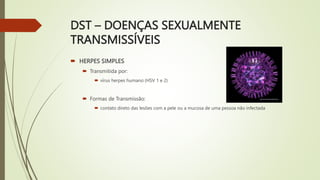 DST – DOENÇAS SEXUALMENTE
TRANSMISSÍVEIS
 HERPES SIMPLES
 Transmitida por:
 vírus herpes humano (HSV 1 e 2)
 Formas de...