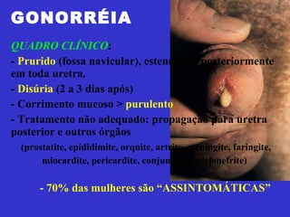 GONORRÉIA QUADRO CLÍNICO :  -  Prurido  (fossa navicular), estendendo posteriormente em toda uretra. -  Disúria  (2 a 3 dias após)  - Corrimento mucoso >  purulento - Tratamento não adequado: propagação para uretra posterior e outros órgãos  (prostatite, epididimite, orquite, artrite, meningite, faringite, miocardite, pericardite, conjuntivite, pielonefrite) - 70% das mulheres são “ASSINTOMÁTICAS” 
