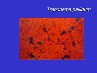 Treponema pallidum 