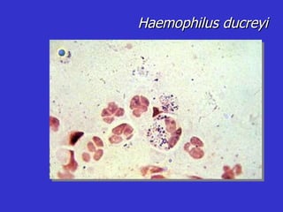 Haemophilus ducreyi 