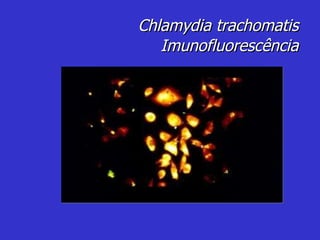 Chlamydia trachomatis Imunofluorescência 