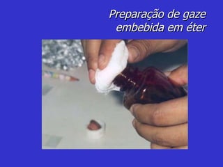 Preparação de gaze embebida em éter 