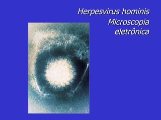 Herpesvirus hominis Microscopia eletrônica 