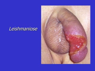 Leishmaniose 